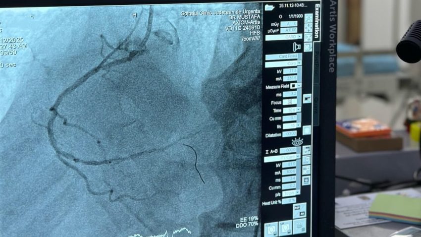 SCJU Constanța: 100 de proceduri coronariene efectuate în Laboratorul de Angiografie și Cateterism Cardiac