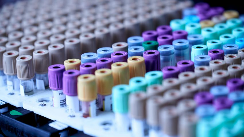 Specialiștii DSP Arad spun că infecția cu hantavirus confirmată era una cronică, nu recentă