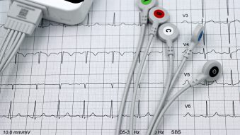Managerul SJU TULCEA: minimum trei luni până la reluarea cardiologiei intervenționale