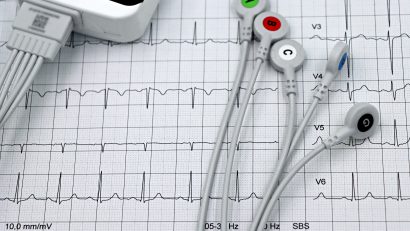 Managerul SJU TULCEA: minimum trei luni până la reluarea cardiologiei intervenționale