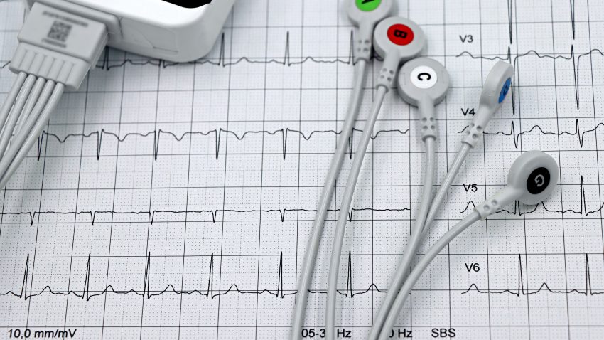 Managerul SJU TULCEA: minimum trei luni până la reluarea cardiologiei intervenționale